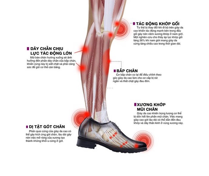 Tác hại không nhỏ đến chân