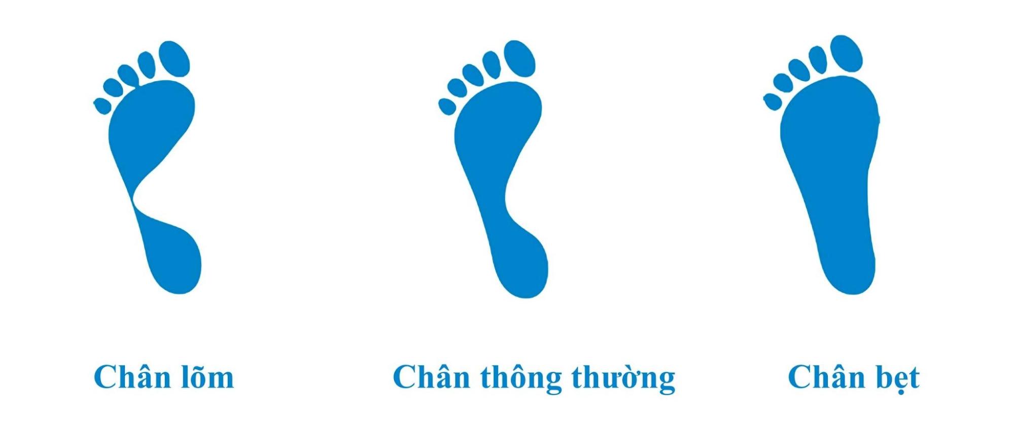 Bàn chân thường có 3 hình dạng